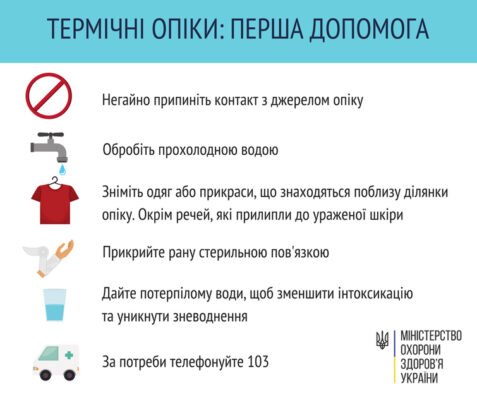 Що робити при опіках: народні методи лікування у домашніх умовах