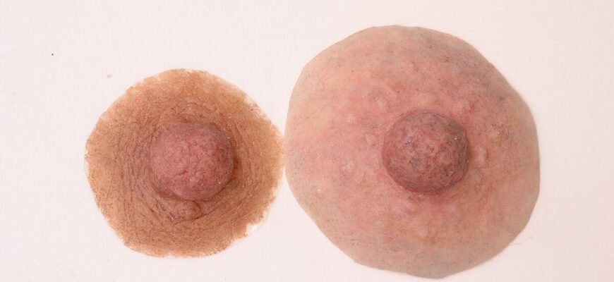 Як виглядають здорові соски: ознаки та особливості зовнішнього вигляду