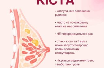 Як позбутися кісти в грудях: народні методи лікування
