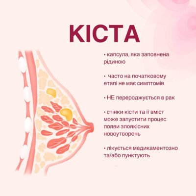 Як позбутися кісти в грудях: народні методи лікування