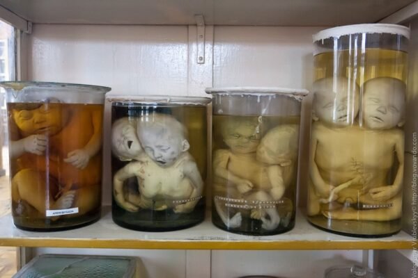 Музей хвороб людини: інтерактивні зображення, що вражають уяву