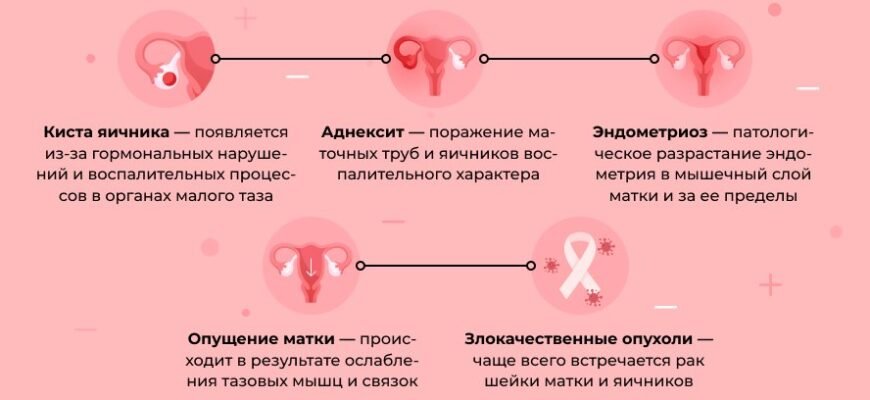 “Біль при овуляції віддає в задній прохід: причини та способи полегшення”