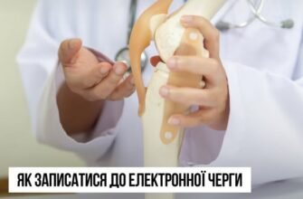 Як стати на чергу по заміні суглоба: покрокова інструкція та поради