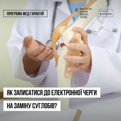 Як стати на чергу по заміні суглоба: покрокова інструкція та поради