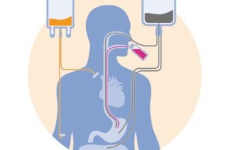 Ентеральне харчування: важливість та переваги підтримки організму