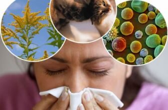 Як лікувати алергію в домашніх умовах: поради та рекомендації