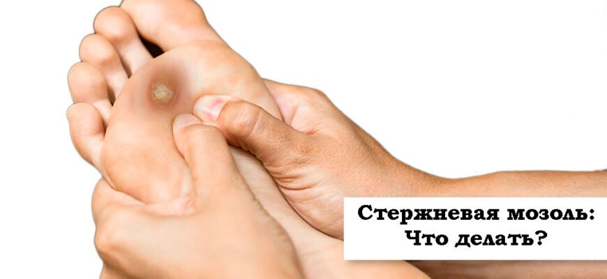 Як ефективно видалити мозоль з коренем: поради та методи
