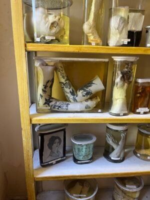 Музей хвороб людини: подорож у світ медичних загадок та історій