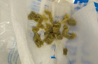 Як виглядають аскариди в калі: ознаки та діагностика паразитів