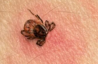 Як витягнути кліща, якщо він розірвався: поради та інструкції