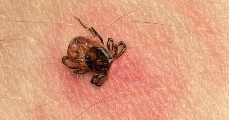 Як витягнути кліща, якщо він розірвався: поради та інструкції