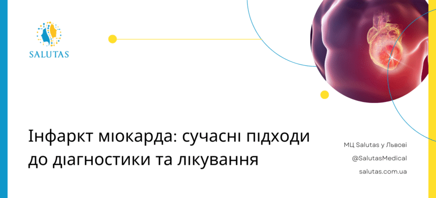 Сучасні методи лікування інфаркту міокарда: ефективні рішення сьогодні