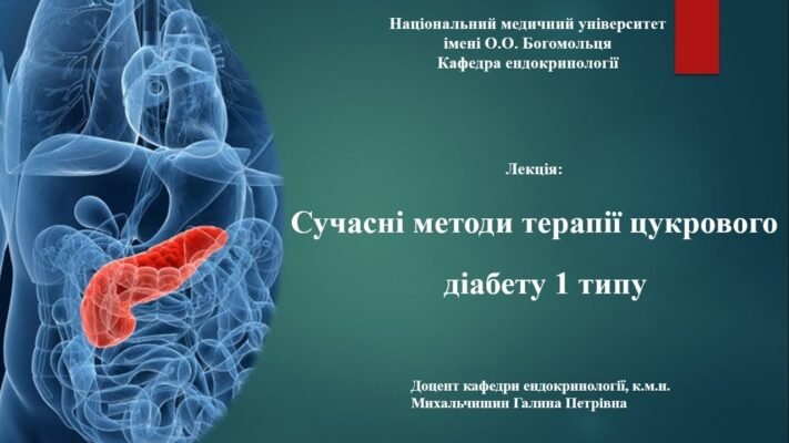 Сучасні методи лікування цукрового діабету 1 типу: нові підходи