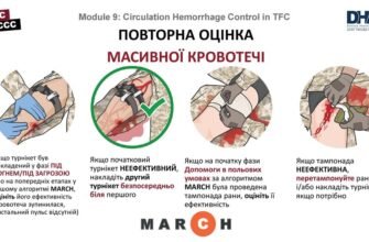 Які методи зупинки критичної кровотечі: ефективні рішення та поради