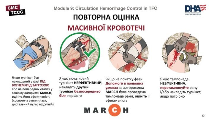 Які методи зупинки критичної кровотечі: ефективні рішення та поради