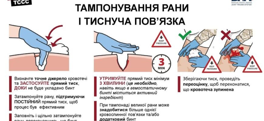 Ефективні методи тимчасової зупинки кровотечі: огляд і поради Ефективні методи тимчасової зупинки кровотечі: огляд і поради