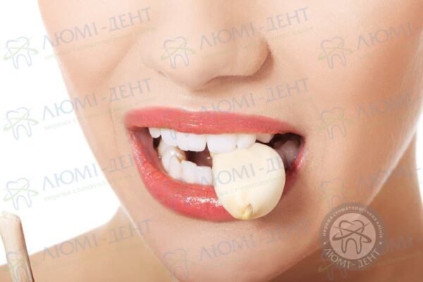 Що робити, коли болить зуб: ефективні народні методи лікування