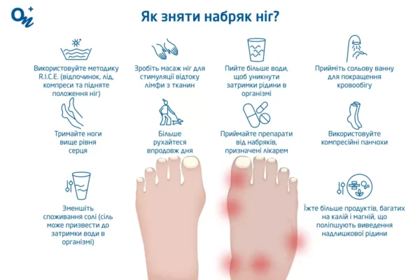 Народні методи зняття набряку ніг: ефективні рішення та поради