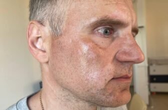 Відгуки тих, хто вилікував вітиліго: реальні історії успіху