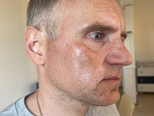 Відгуки тих, хто вилікував вітиліго: реальні історії успіху