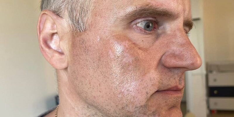 Відгуки тих, хто вилікував вітиліго: реальні історії успіху