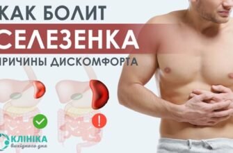 Як болить селезінка: симптоми і причини дискомфорту в лівому боці