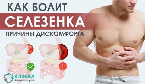 Як болить селезінка: симптоми і причини дискомфорту в лівому боці