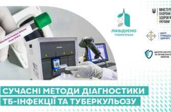 Сучасні методи діагностики туберкульозу: новітні підходи та технології