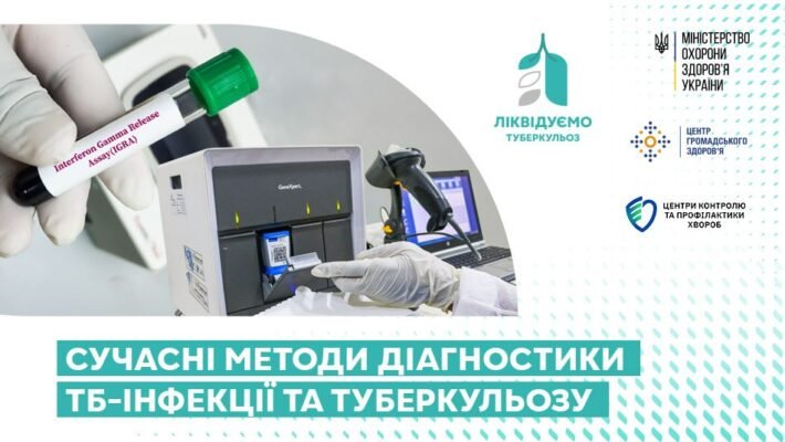 Сучасні методи діагностики туберкульозу: новітні підходи та технології
