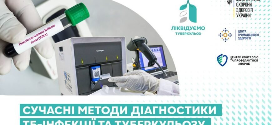 Сучасні методи діагностики туберкульозу: новітні підходи та технології Сучасні методи діагностики туберкульозу: новітні підходи та технології