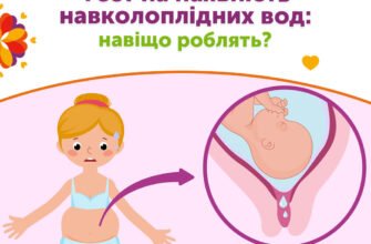 Як відрізнити підтікання вод від виділень: корисні поради для жінок