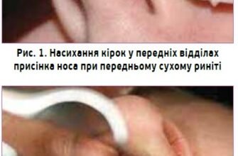 Сухість в носі: ефективні народні методи лікування для полегшення