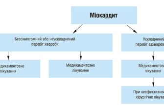 Лікування дифузних змін міокарда: ефективні методи та поради