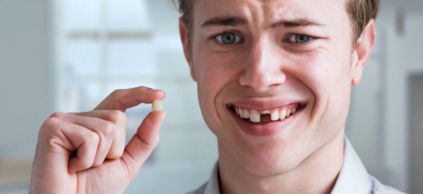 Чи можна ходити без зуба: ризики та поради стоматологів