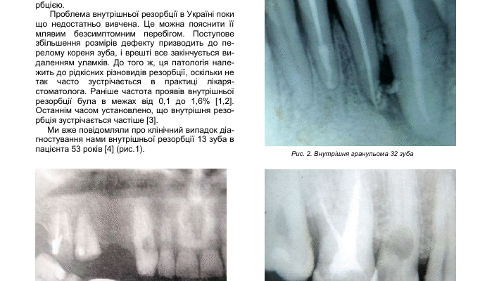 Репаративні зміни: що це таке і як вони впливають на організм?