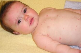 Причини та наслідки: чому нейтрофіли підвищені у дитини?