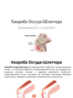 Хвороба Шляттера у дітей: причини, симптоми та лікування