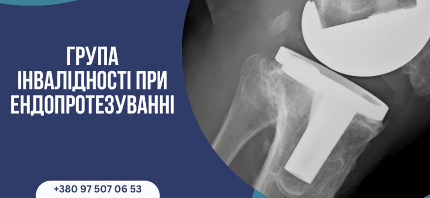 Яка група інвалідності при заміні суглоба: детальний огляд критеріїв