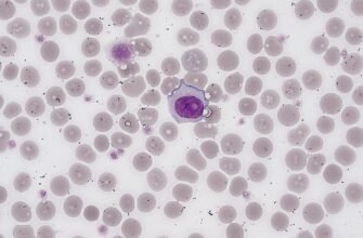 Підвищені тромбоцити у дитини: причини, симптоми та лікування