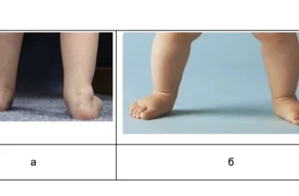 У дитини болять ноги: обговорення і поради батьків на форумі