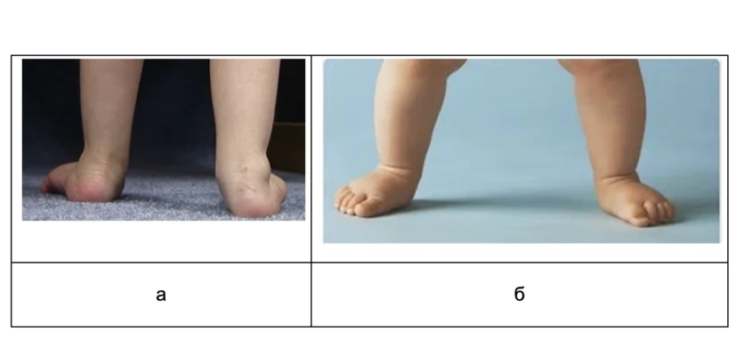 У дитини болять ноги: обговорення і поради батьків на форумі