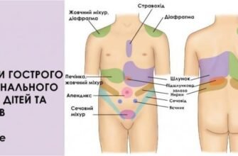Біль в животі у дитини: причини, симптоми та лікування