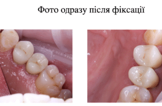 Чи можна змінити колір коронки: огляд можливостей та методів