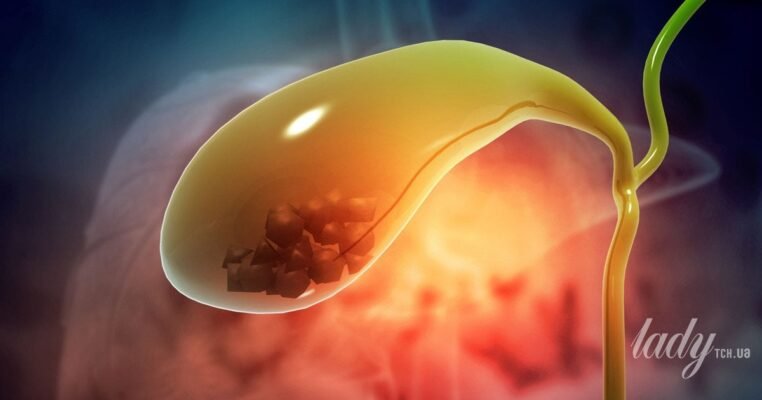 Чи можна фізично працювати після видалення жовчного міхура: важливі поради