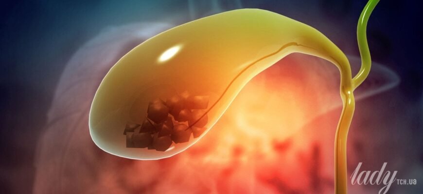 Чи можна фізично працювати після видалення жовчного міхура: важливі поради