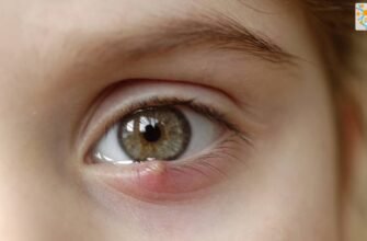 Опухло око у дитини: причини, симптоми і шляхи лікування