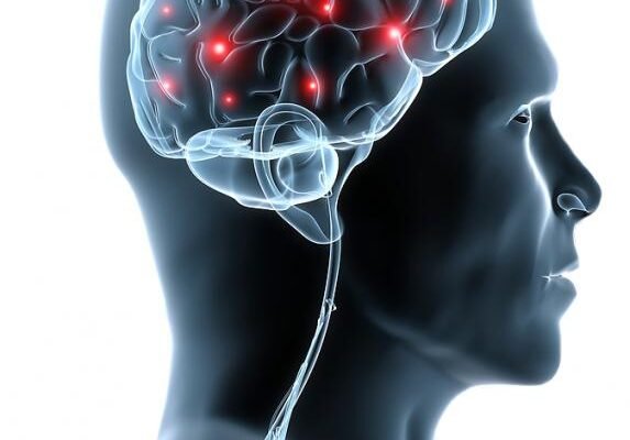 Цереброваскулярна хвороба: причини та основні фактори ризику