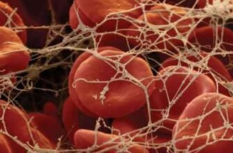 Хвороба крові: причини, симптоми та сучасні методи лікування