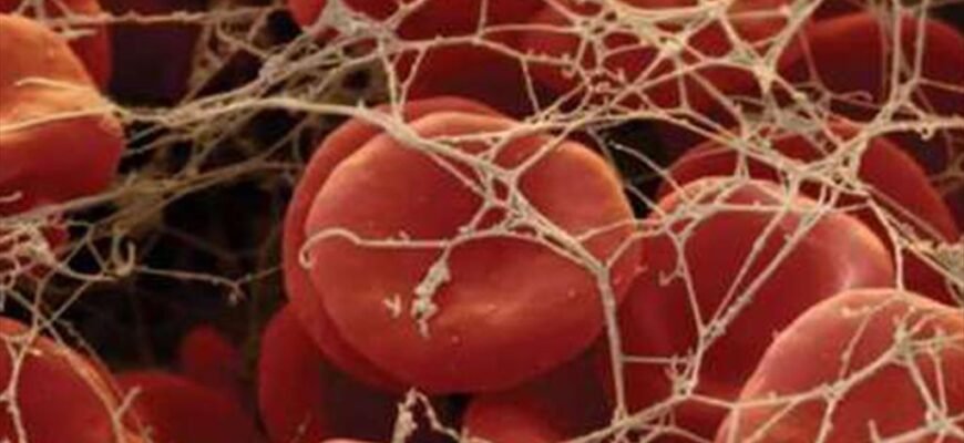 Хвороба крові: причини, симптоми та сучасні методи лікування