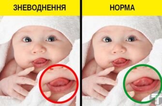 Ротавірус у дитини: симптоми, лікування та профілактика захворювання